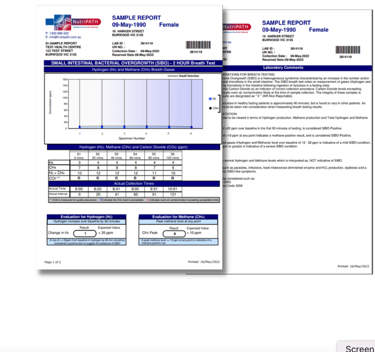 SIBO Breath Test